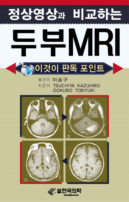 정상영상과 비교하는 두부 MRI